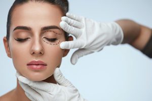 blefaroplastia